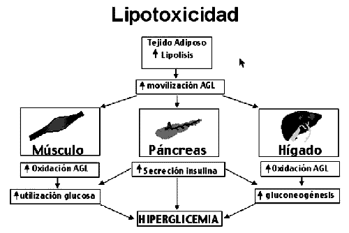 Glucotoxicidad y lipotoxicidad: factores en la patog\u00e9nesis y evoluci\u00f3n ...